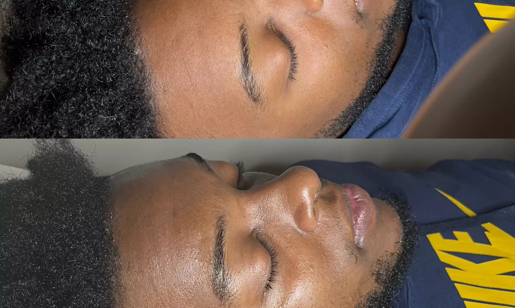 Up to 20% Off on Facial at Zen WYN Spa - Second Medium