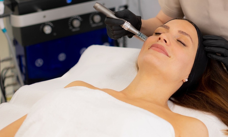 Image 2: Up to 60% Off on Micro-Needling at Modern Wellness & Beauty