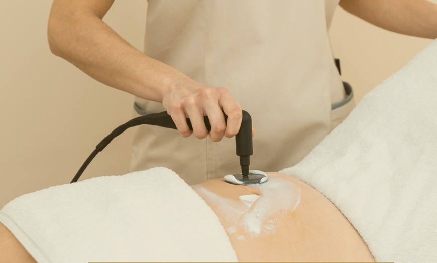 Image 11: Radiofrecuencia Indiba Edna en Clínica Novastetic Barrio de Salamanca