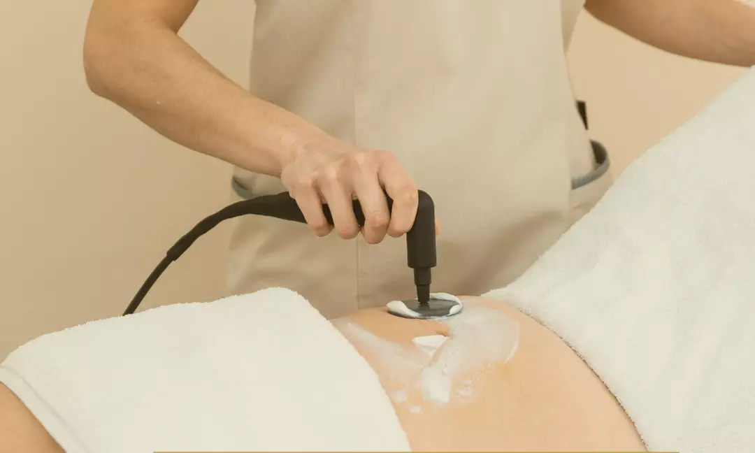 Radiofrecuencia Indiba Edna en Clínica Novastetic Barrio de Salamanca