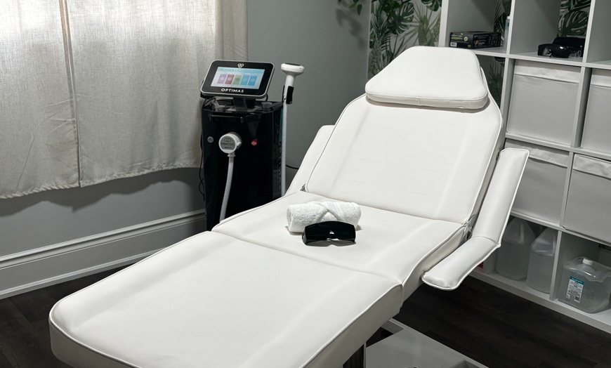 Image 2: Smooth Skin w/ Six Laser Hair Removal on Small, Medium or Large Areas