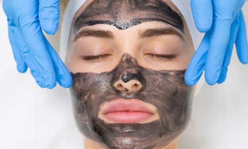 Image 1: Laserowy peeling węglowy na twarz z opcjonalną maską algową