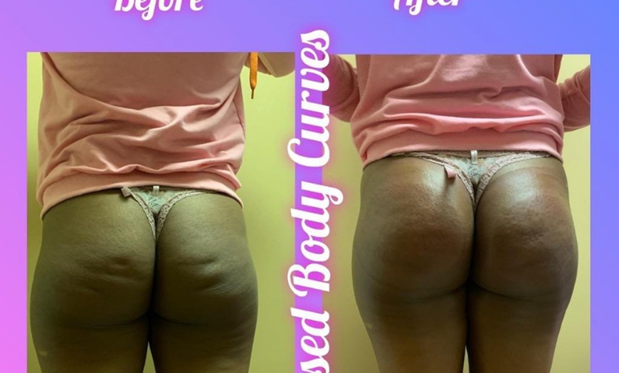 Image 1: Up to 84% Off on Lipo - Non-Invasive Laser-iLipo at Blessed Body Curves