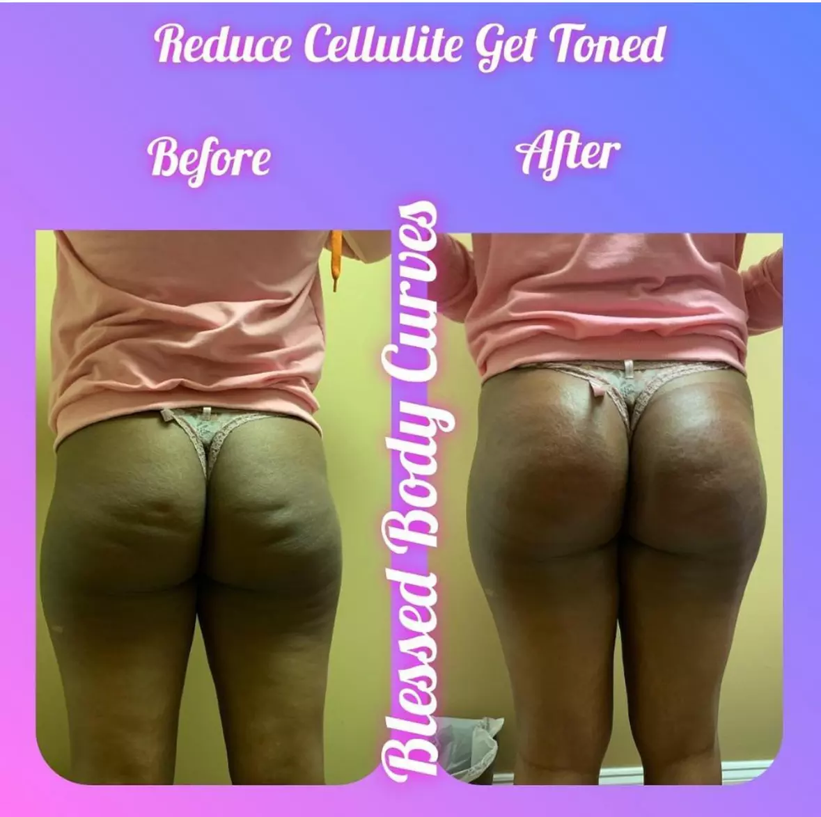 Up to 84% Off on Lipo - Non-Invasive Laser-iLipo at Blessed Body Curves