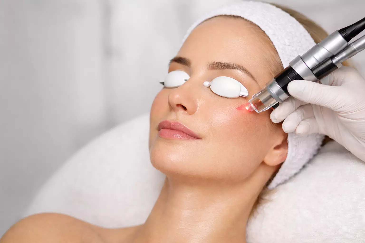 Transform your look with Kefi Advanced Laser And Skin's full face CO2 laser treatment, offering up to 40% off - Primary Image