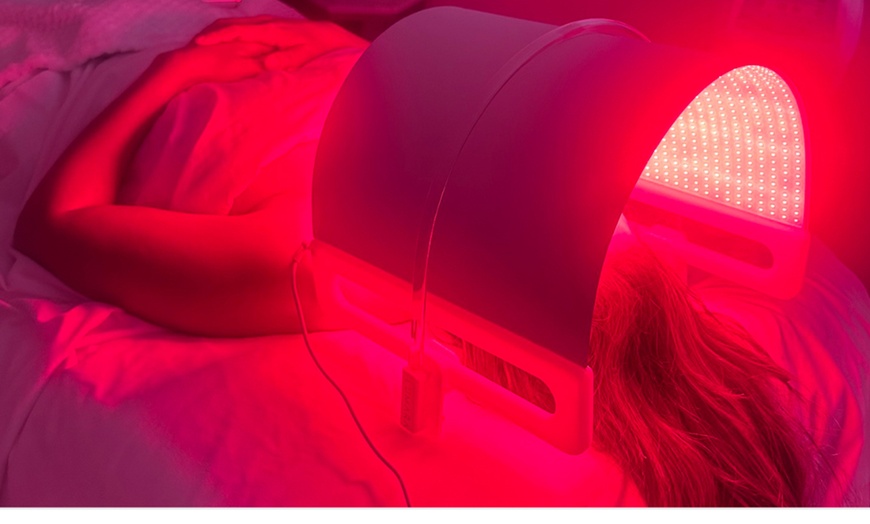 Image 4: Up to 58% Off on Micro-Needling at Refined Radiance Aesthetics, Westlake Village