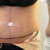 Image 5: Post-Op Lymphatic Massage at Post op curves(Up to 60% Off)