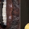 Image 12: Dental Crowns, Dental Exam, X-rays & Cleaning, Dentures & More