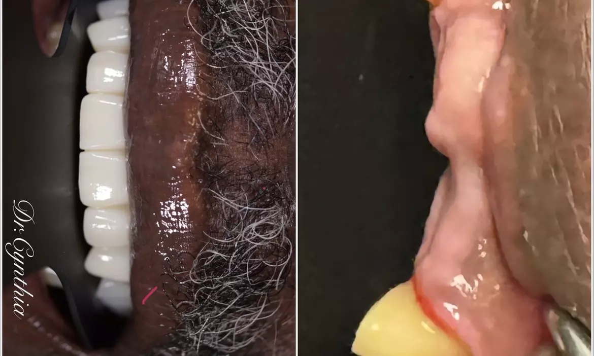 Dental Crowns, Dental Exam, X-rays & Cleaning, Dentures & More