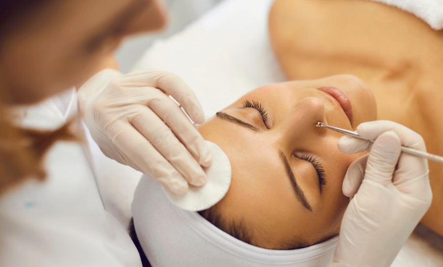 Image 3: 60-Minute Deep Pore Cleansing Facial and Diamond-Tip Microdermabrasion