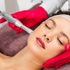 Image 1: Dermaplane (Fresh & Glow) & Microneedling +HA - 1, 2, 3, or 6 Sessions
