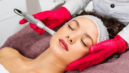 Dermaplane (Fresh & Glow) and Microneedling + HA - One Session - Glow Matrix