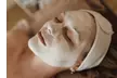 Up to 35% Off on HydraFacial at Spotzen Wellness Center - Second Medium