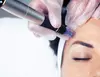 One or Three Micro Needling Treatments + Acupuncture Session (Up to 50% Off)