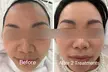 Up to 77% Off on Pampering Package at SkinVital Studio - Second Medium