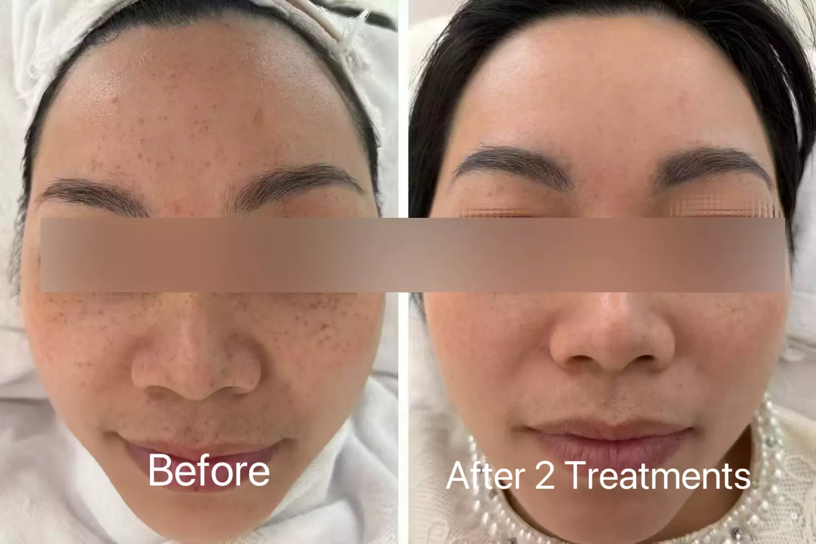 Up to 77% Off on Pampering Package at SkinVital Studio