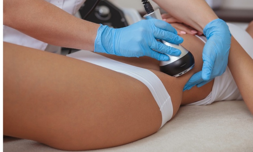 Image 4: Achieve Visible Results With One, Three or Six Cavitation Sessions