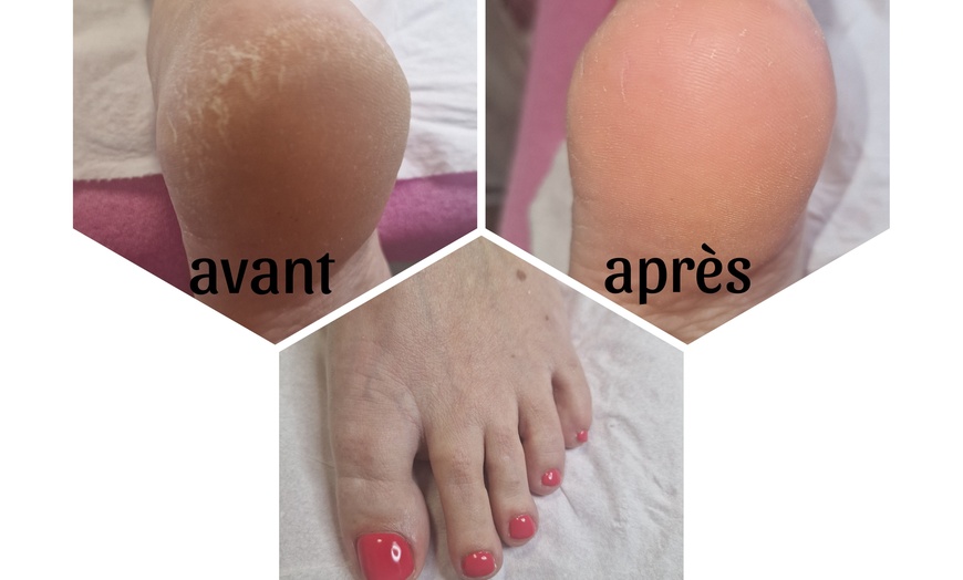 Image 2: Beauté des pieds russe avec pose de vernis semi-permanent
