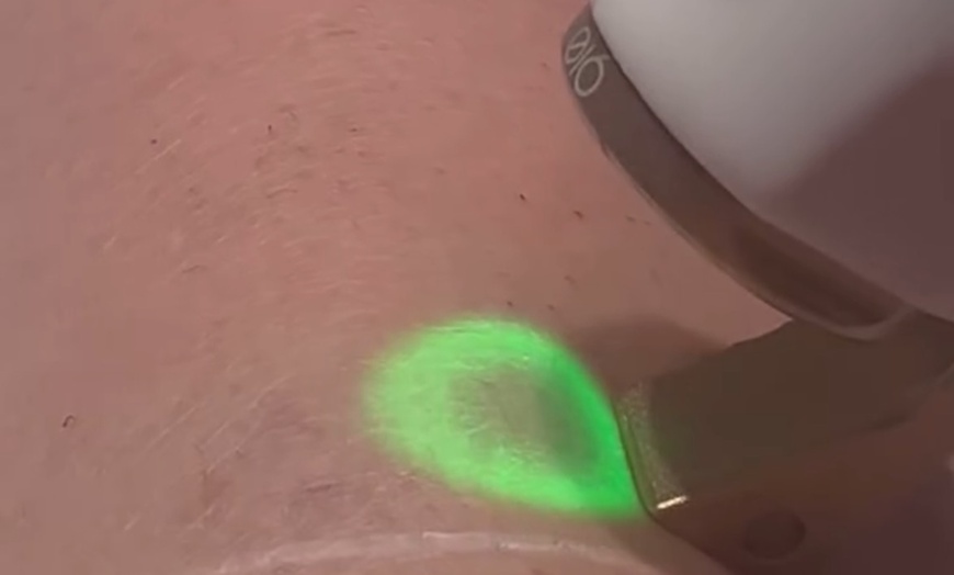 Image 3: 8 séances d'épilation laser jambes et maillot ou aisselles et maillot 