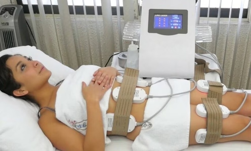 Image 3: Enjoy a Custom Pack of One or Five Treatments at Be In Shape