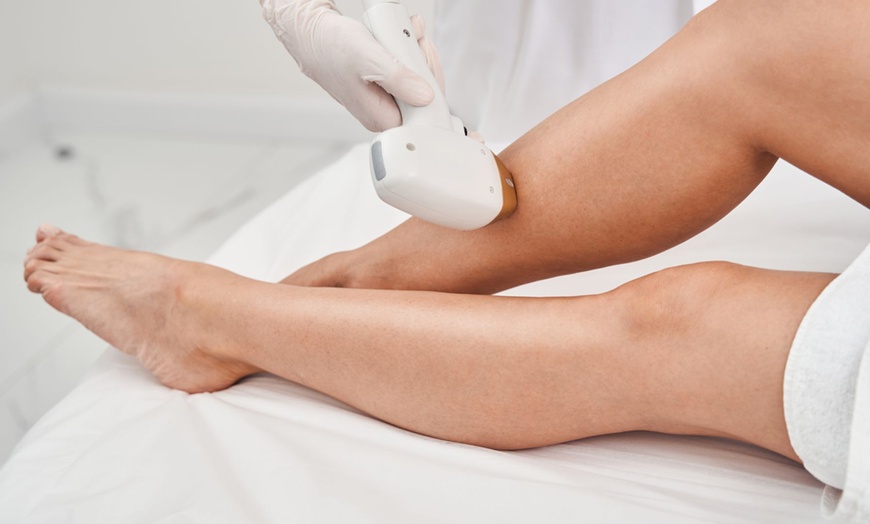 Image 3: Up to 50% Off on Laser Hair Removal at Modern Wellness & Beauty