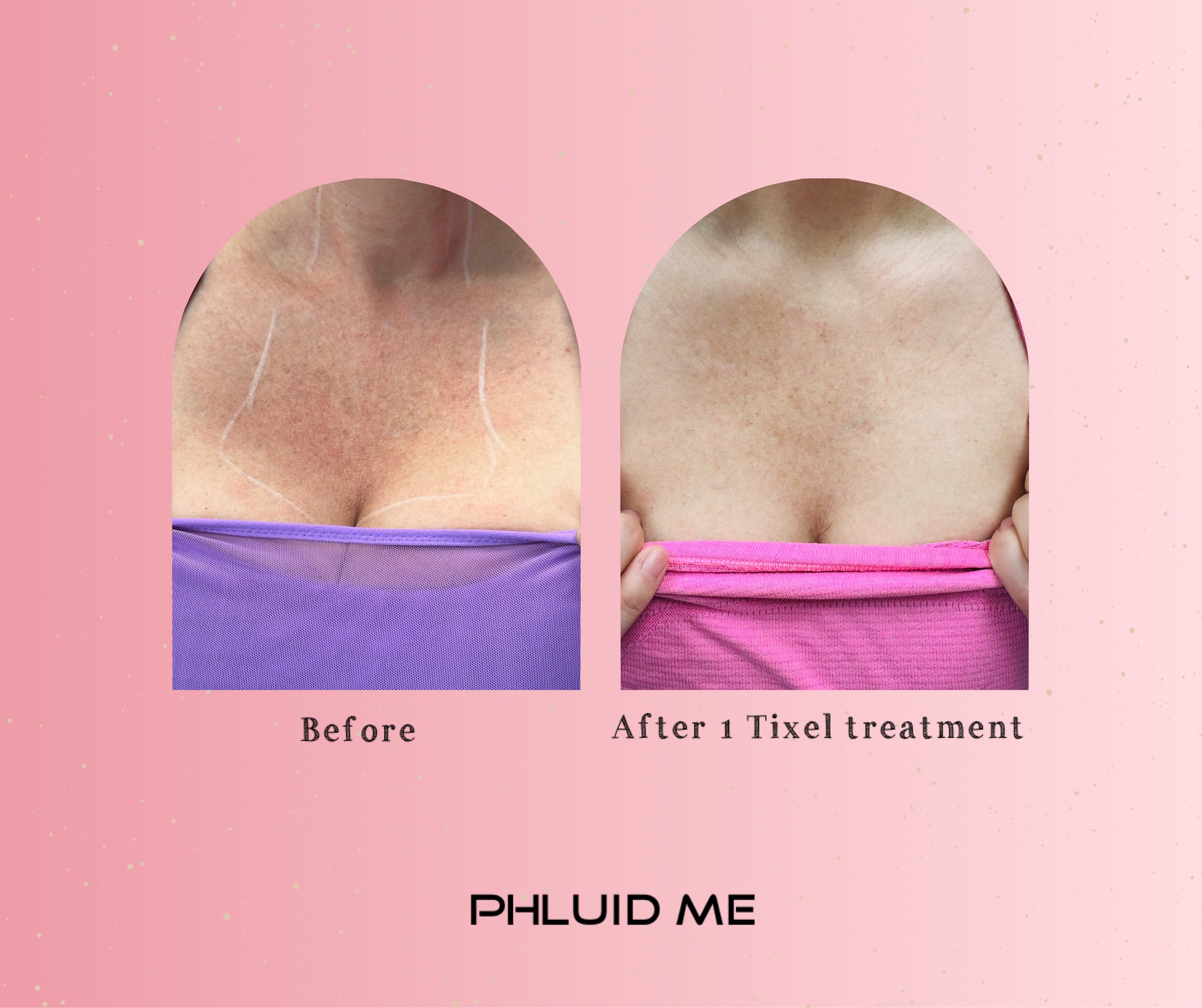 Lift, Tighten, Glow – Thermal Treatments for Face, Eyes, and Lips