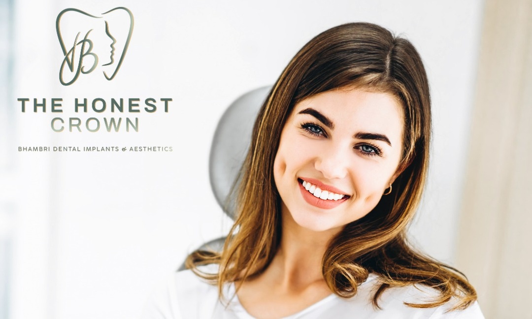 Transform Your Smile: One, Two or Three Dental Implants with Abutments and Crowns - Up to 30% Off