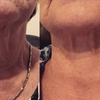Image 5: Up to 64% Off on Radio Frequency Microneedling at Revitamaxx