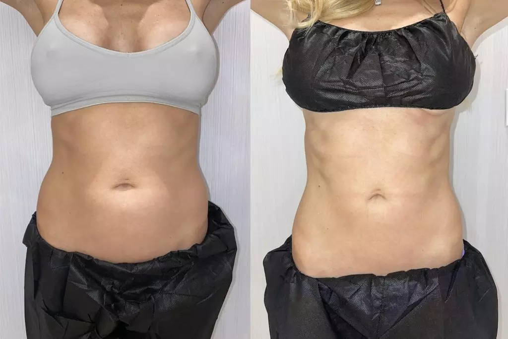 Achieve Your Fitness Goals with 4, 6, or 8 EMS Sessions at Cyberskin Tattoos & Body Mod By Viva (Up to 30% Off) - Second Medium