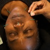 Image 2: Up to 43% Off on Acupuncture at The Golden Life Acupuncture