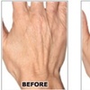 Image 3: One Syringe of Radiesse for Neck / Décolleté and Hand Rejuvenation at No Pain All Gain Spa (Up to 30% Off)