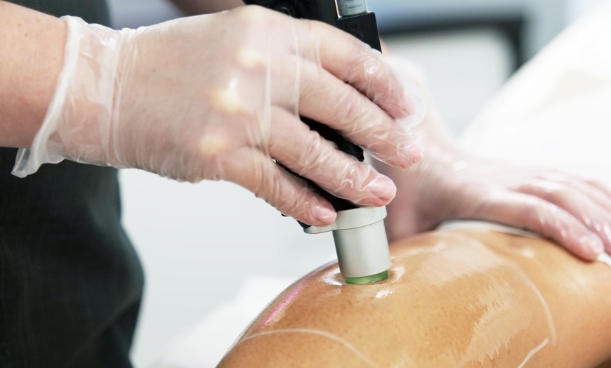 Image 2: Three or Six Laser Hair Removal Sessions for a Small or Medium Areas