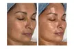 45% Off Advanced Chemical Peel or 2-Hour Anti-Aging Facial – Glow & Rejuvenate at RISE Skin Spa, La Jolla - Second Medium