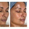 Image 4: Advanced Chemical Peel or 2-Hour Anti-Aging Facial at RISE Skin Spa