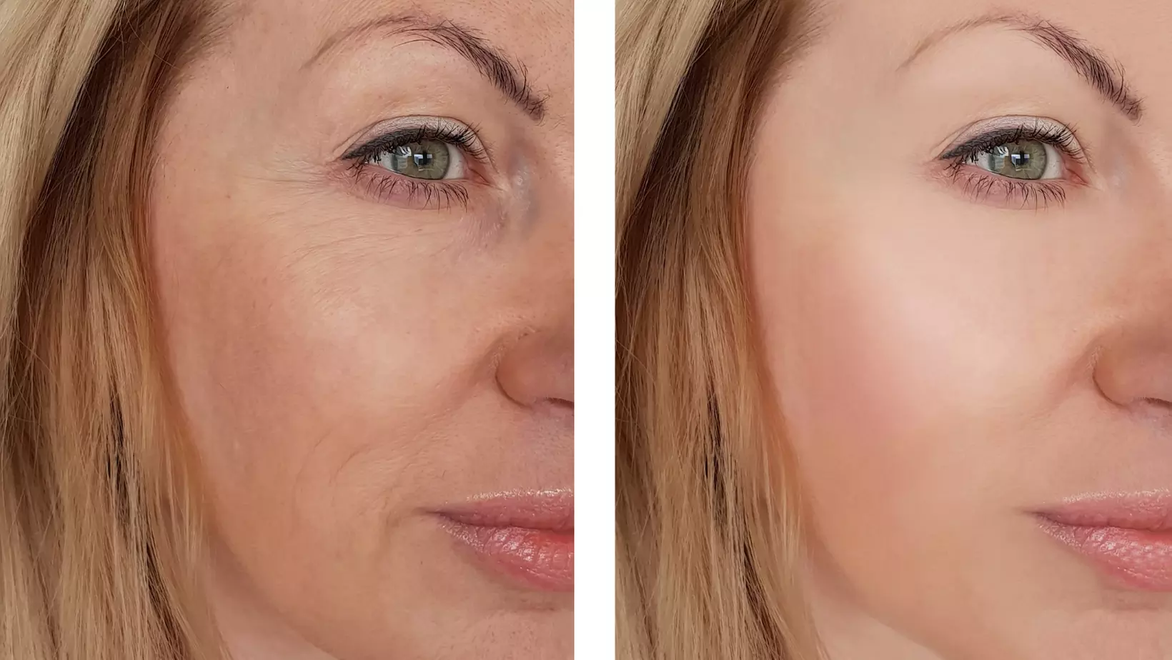 Up to 38% Off on Facial at PLEROO Therapeutics - Primary Image
