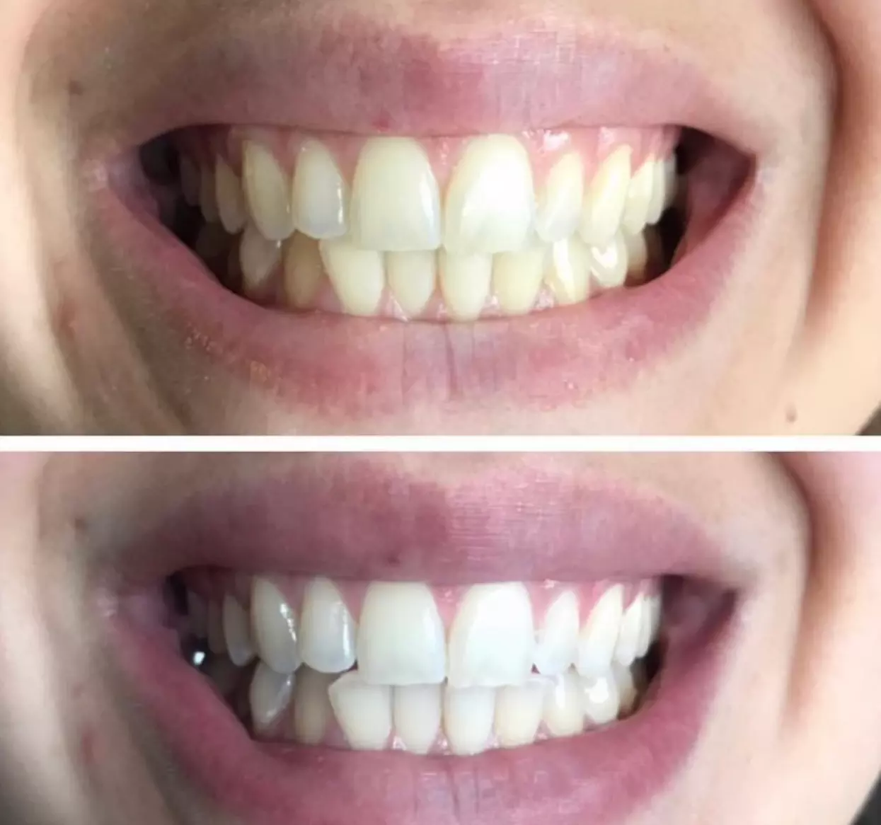 Up to 48% Off on Teeth Whitening at Luxe Beauty Bar Fresno - Primary Image
