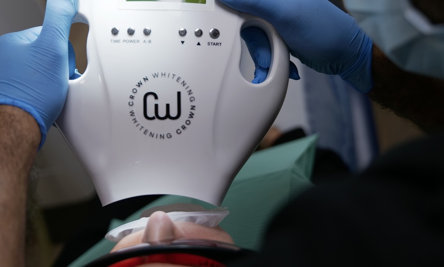 Image 1: In-Office Crown Whitening Treatment with Consultation and Optional Whitening Kit at Green Dental (Up to 52% Off)