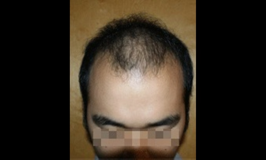 Image 3: Hair, Scalp Analysis and Take Home Product with Optional Treatment