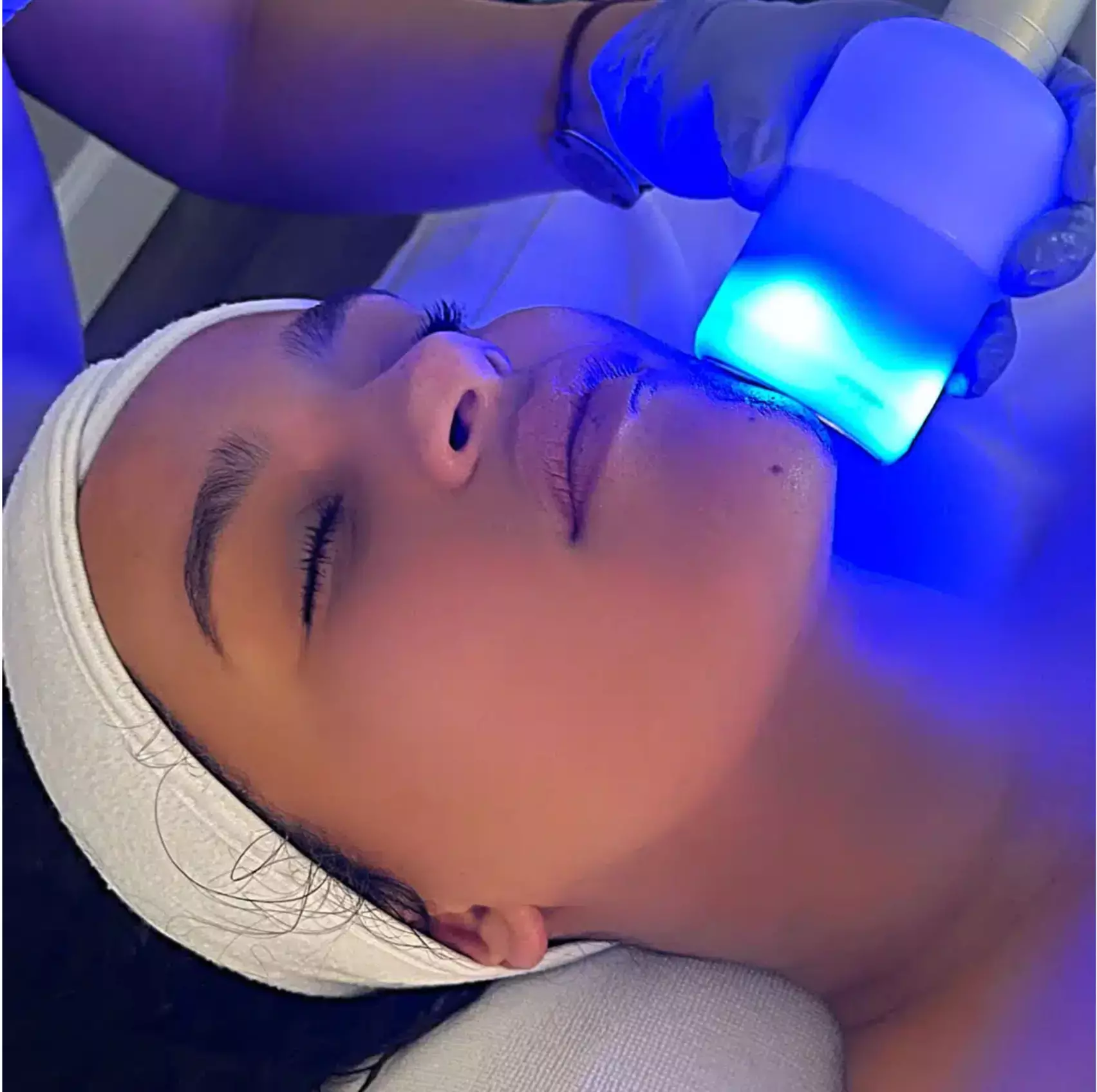 Rejuvenate with  1 or 2 Cryo Facial or Cryo-Target Spot Treatment at Laser Esthetic Studio - Up to 68% Off - Primary Image