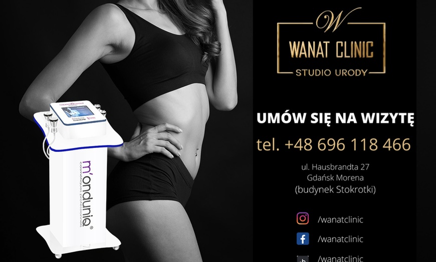 Image 1: Redukcja tłuszczu/cellulitu w firmie Wanat Clinic Studio Urody