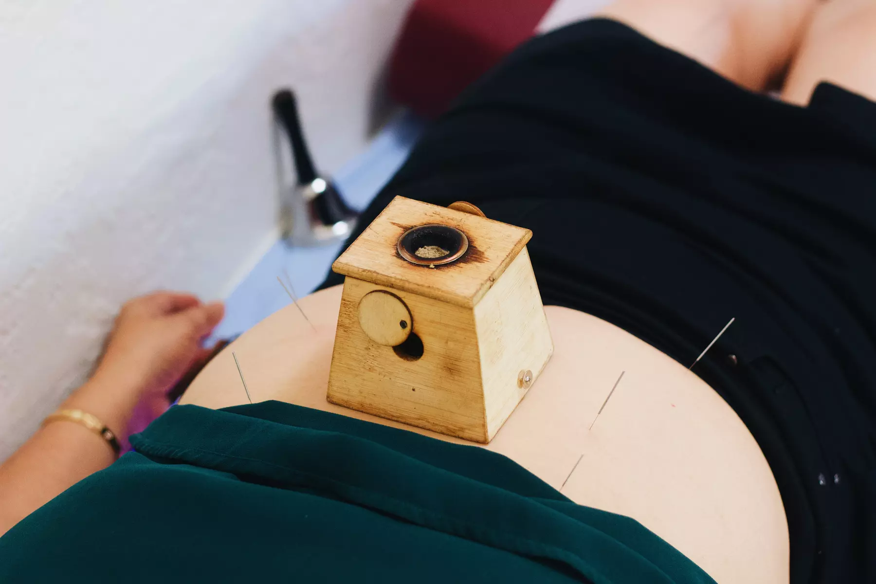 Rejuvenate Your Body: Cryotherapy, Acupuncture and More