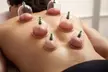 10-Minute Trial Chair Massage, Cupping Therapy or Thai Massage at SAMSAM'S BODYWORK & MASSAGE (Up to 30% Off) - Second Medium