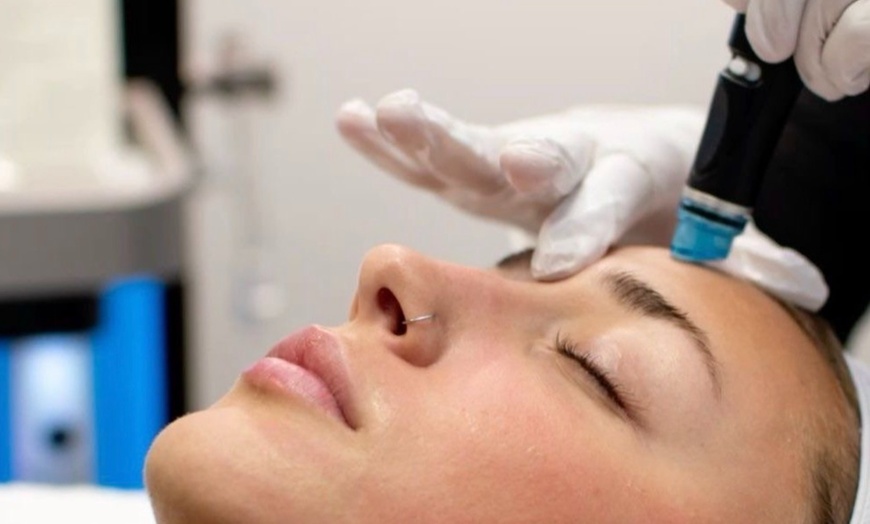 Image 3: One or Two Sessions of Hydra Dermabrasion with LED Therapy