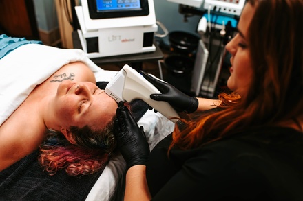 ONE HIFU Skin-Tightening - Consultation and test patch - Panda Pampering