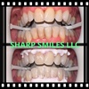 Image 1: Brighten Your Smile With Teeth Whitening, Polishing & More 