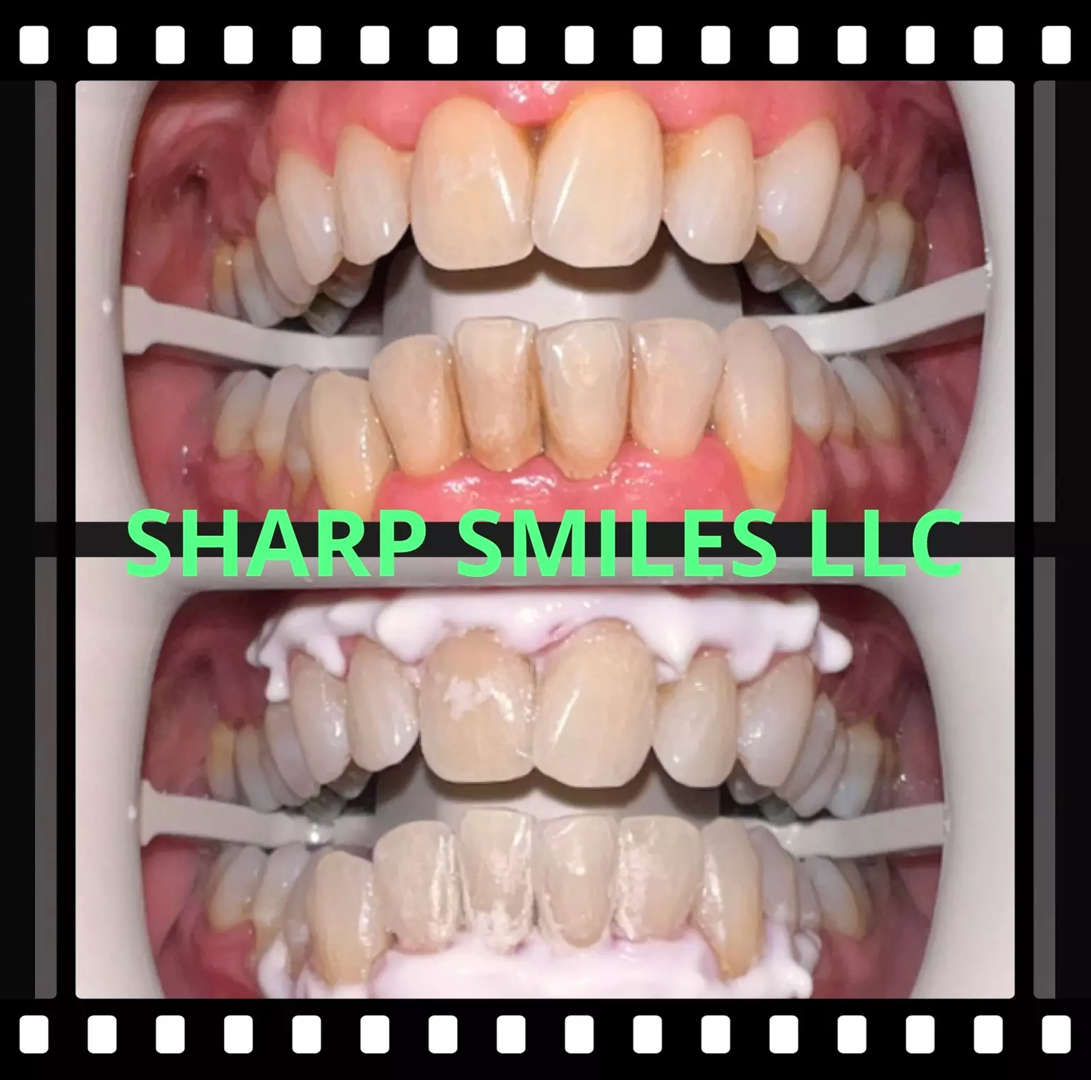 Brighten Your Smile With Teeth Whitening, Polishing & More