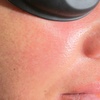 Image 5: Luxury Exosome Mesotherapy with PDRN for Skin Repair & Radiance