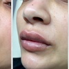 Image 7: Up to 25% Off on Facial - Anti-Ageing at Tranquil Aesthetics