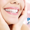 Image 2: Get a Brighter Smile in One Hour with Teeth Whitening, Consultation and Optional Whitening Kit (Up to 52% Off)