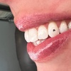 Image 4: Sparkle up with One or Two Tooth Gems for a Bright Smile